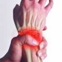 Cumulative Trauma Disorders