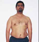 Moustafa Before