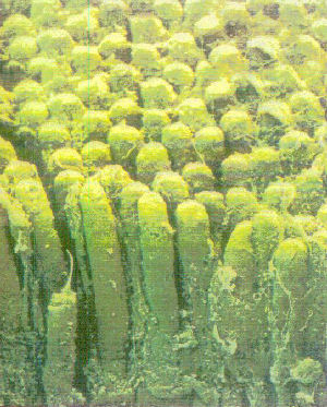 Toxin filled Digestive Tract